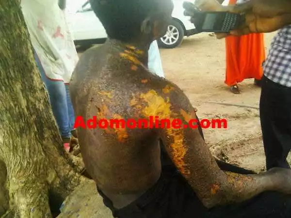 Heartless Man Who Bathed His Girlfriend with Acid for Jilting Him Arrested by Police (Photo)